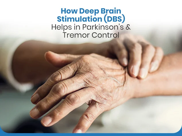 How Deep Brain Stimulation (DBS) Helps in Parkinson’s & Tremor Control